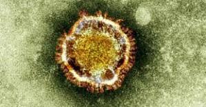 Las primeras muestras de nuevo coronavirus patentadas por laboratorio privado