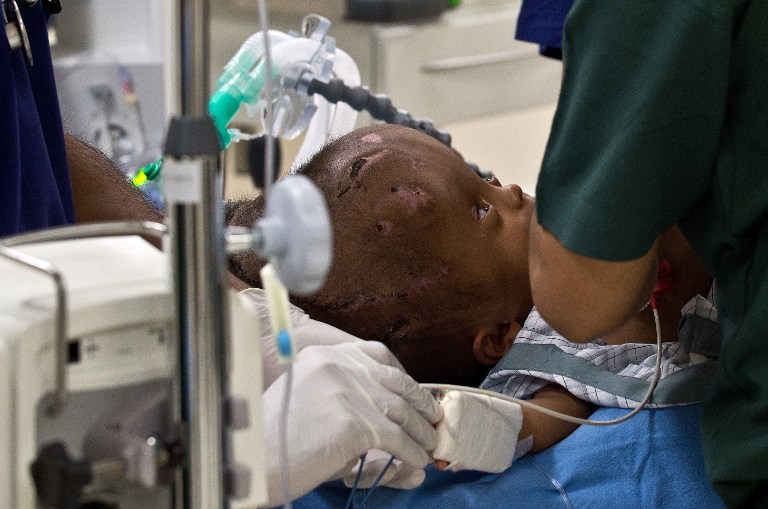 Cirujanos indios reconstruyeron la cabeza de una niña hidrocefálica (Fotos)