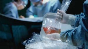Organizaciones piden reactivar Sistema de Procura de Órganos tras estar paralizado