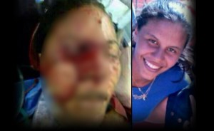 Falleció la estudiante herida por perdigón en el ojo en Carabobo (Video)