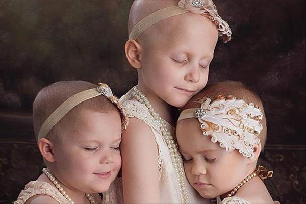 ¡Conmovedor! La foto de tres niñas sobrevivientes al cáncer que se volvió viral