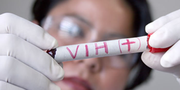 Descubren que el VIH usa una familia de células inmunitarias para propagarse