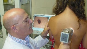 Descubren un mecanismo que causa la metástasis del melanoma y cómo frenarlo