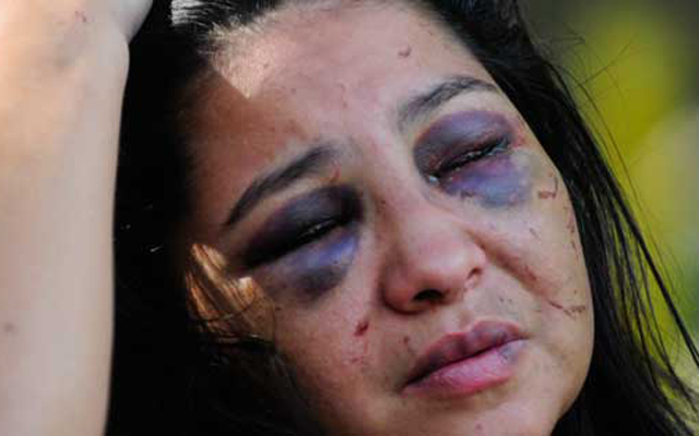 Mujer que fue brutalmente golpeada por Polivargas: Me torturaron y me dejaron presa  (VIDEO)