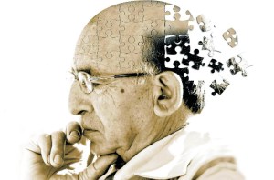 ¿Qué se sabe del fármaco contra el alzhéimer aprobado en EEUU?