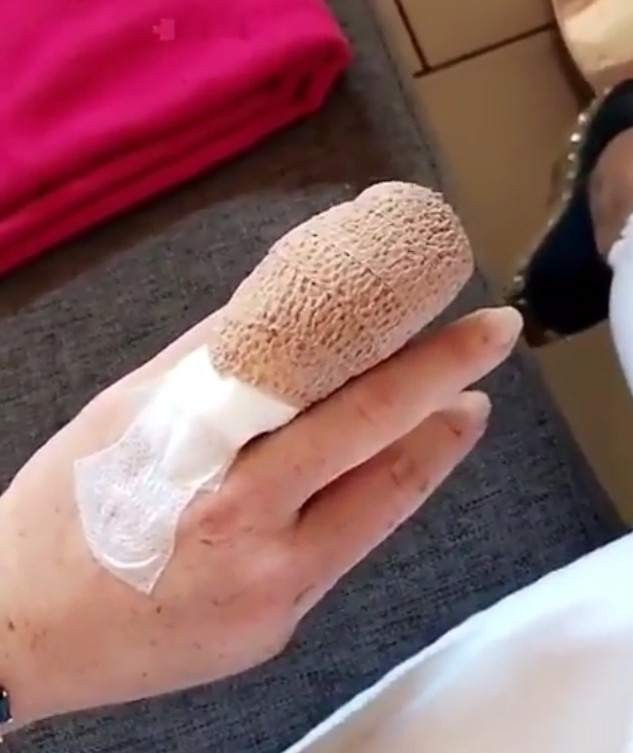 La actriz Lindsay Lohan pierde parte del dedo anular en un accidente (foto)