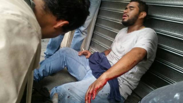 Uno de los heridos en Plaza Altamira recibe un cigarrillo a petición porque no aguanta el dolor. Foto: @HAIDYRODRIGUEZ