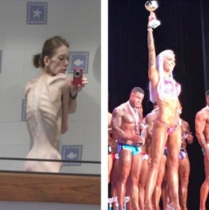 ¡OMG!… La impresionante transformación de una anoréxica a campeona de fisicoculturismo (Fotos)