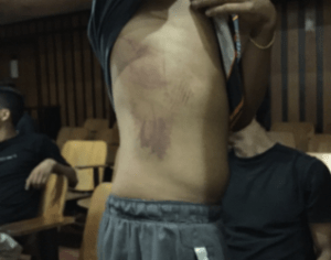 Denuncian violación a joven detenido en Aragua #18May