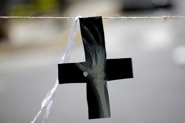 A cross made of an X-ray hangs on a street barricade after a strike called to protest against Venezuelan President Nicolas Maduro's government in Caracas, Venezuela, July 29, 2017. REUTERS/Ueslei Marcelino