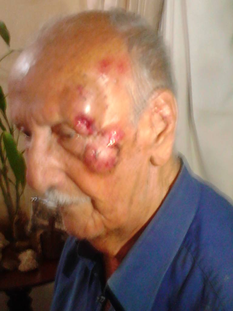 ¡Desalmados!… Así quedó un abuelo tras brutal paliza de la GNB en Mérida (FOTOS)