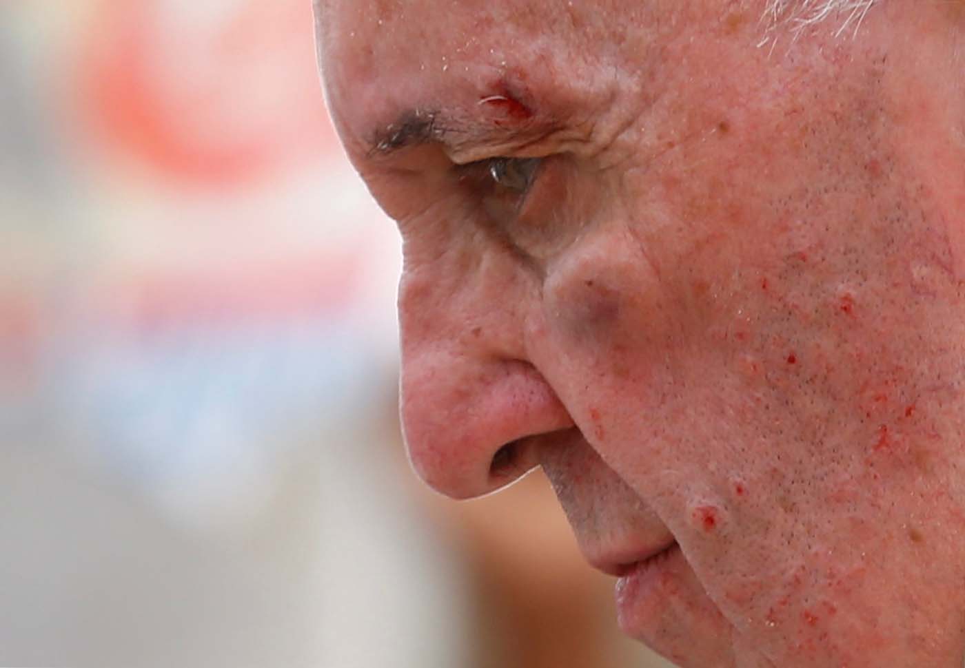 El frenazo que dejó al Papa con un ojo morado (nuevo video)
