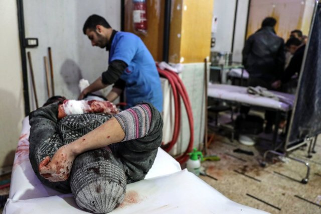 Un hombre herido tras un bombardeo al este de Guta es atendido en un hospital de Duma (Siria), el 20 de febrero de 2018. Como en el resto de cercos del país, a la falta de alimentos se suman unos servicios sanitarios casi inexistentes, fruto de los ataques aéreos contra instalaciones médicas y la alarmante escasez de medicamentos. (Foto: MOHAMMED BADRA / EFE)