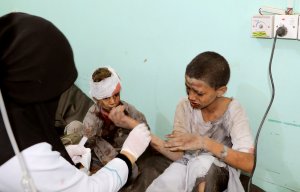 Decenas de muertos y heridos en el ataque contra un autobús que transportaba niños en Yemen
