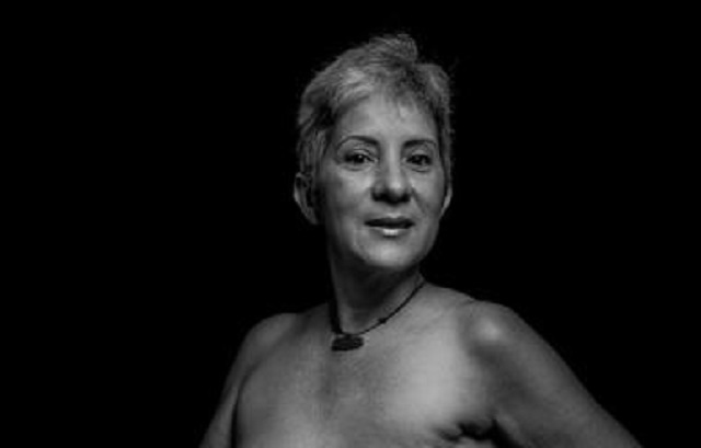 19 de octubre: Mujeres que lograron sobrevivir al cáncer de mama en Venezuela