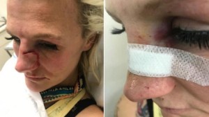La brutal agresión que sufrió la luchadora de MMA Cindy Dandois por parte de su ex novio