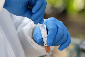 Se elevan a 726 los muertos por coronavirus en Florida