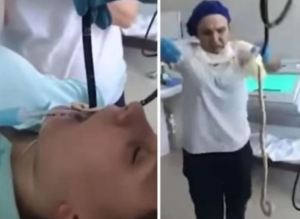Acude al hospital porque no podía respirar… y le sacan una culebra de la garganta (VIDEO)