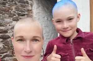 La historia de la niña de nueve años que perdió el cabello por el estrés de la cuarentena