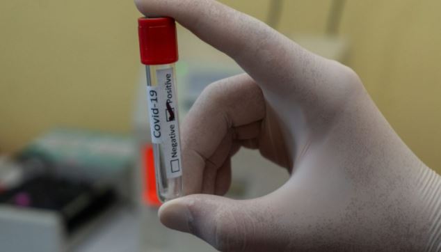 Régimen de Maduro habilitó pruebas PCR para viajeros… y costará más de 80 dólares