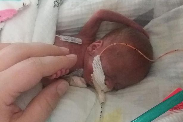 Contra todo pronóstico: El bebé más prematuro del mundo celebró su primer cumpleaños en EEUU