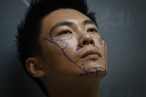 En China, los hombres recurren a la cirugía estética para tener mejores oportunidades profesionales