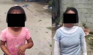 Anciana le quemó el rosto a su nieta e hija con síndrome de Down en México