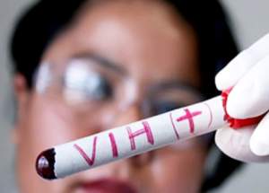 Aumento alarmante: casos de VIH en Carabobo se han incrementado en más del 40%