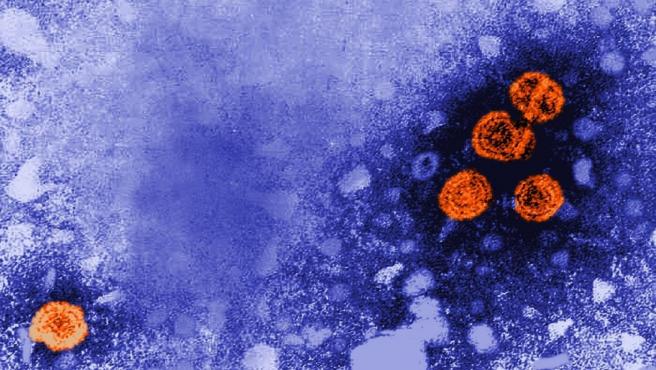 Un “agente infeccioso” podría estar detrás de la hepatitis de origen desconocido en niños, alerta la UE