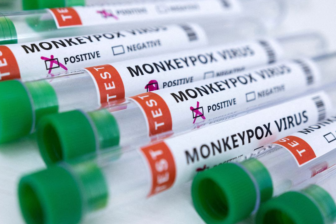 Colombia reportó primeros casos de viruela del mono