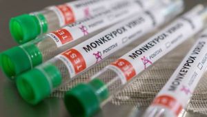 La OMS mantiene el nivel de alerta máxima para la viruela del mono