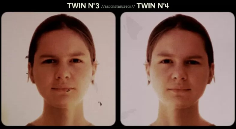 La historia de las gemelas que fueron separadas al nacer como parte de un oscuro experimento en EEUU