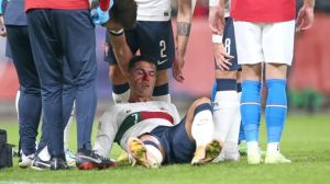 Las fotos del rostro de Cristiano Ronaldo tras el violento golpe en la nariz que sufrió en el último partido de Portugal