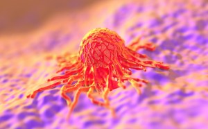 El excepcional caso de una mujer que ha sobrevivido a 12 tumores abre una vía para curar el cáncer