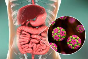 Qué es el norovirus identificado en el brote de gastroenteritis en ciudad de Brasil: síntomas, riesgos y prevención