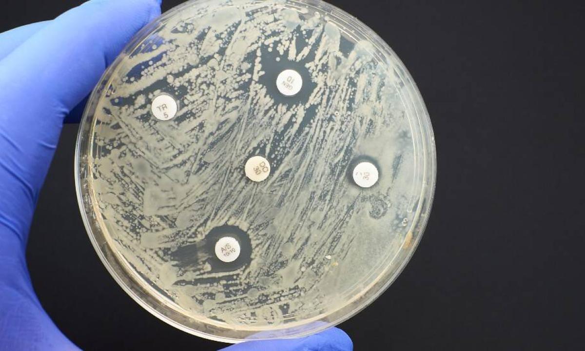 La “pandemia silenciosa” que mata más personas que el Covid-19, la malaria y el sida