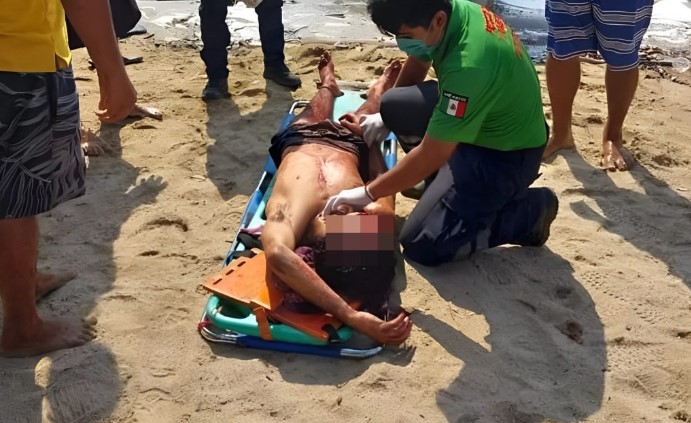 “Por la espalda y sin motivos”: así fue el brutal ataque a machetazos que sufrieron tres personas en playa mexicana