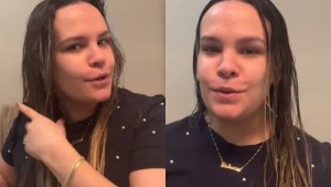VIRAL: venezolana contó por qué se le comenzó a caer el cabello poco tiempo después de llegar a EEUU (VIDEO)