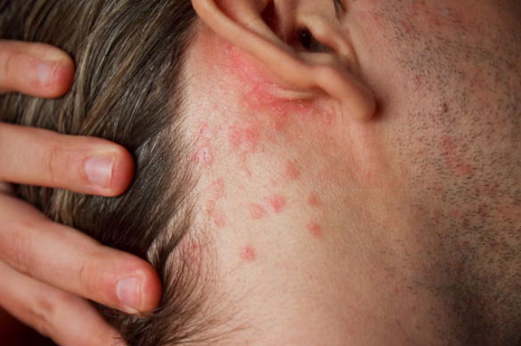 Presta atención: estas son las enfermedades que se manifiestan a través de la piel del rostro