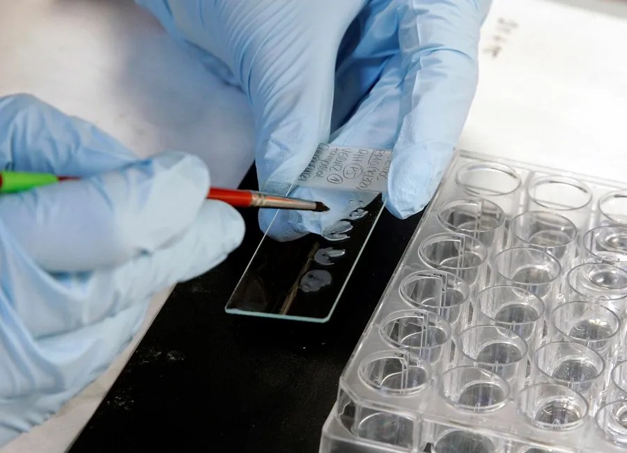 Descubren en España una nueva vía para generar células madre contra la leucemia