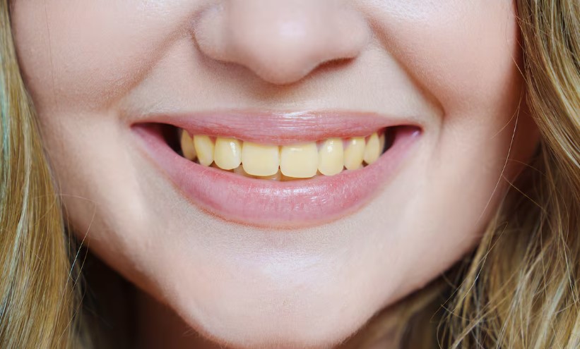 El remedio casero que “afloja” el color amarillo de los dientes