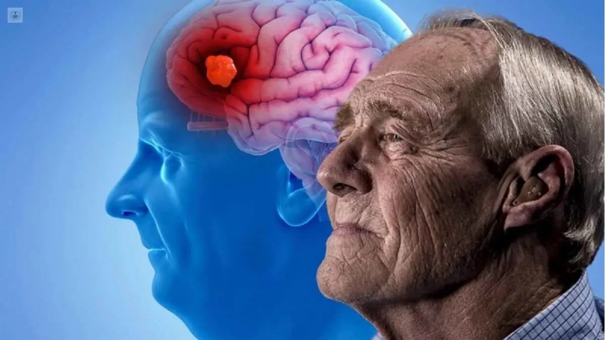 Qué acciones realizar en cada etapa de la vida para prevenir el Alzheimer